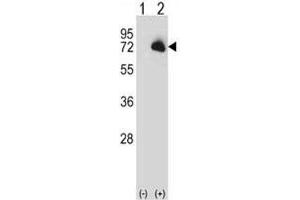 Western blot analysis of BTK antibody and 293 cell lysate (2 ug/lane) either nontransfected (Lane 1) or transiently transfected (2) with the BTK gene. (BTK Antikörper  (AA 27-55))