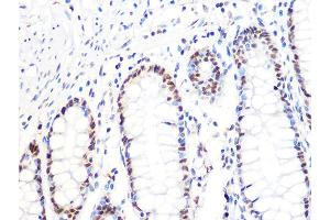 Immunohistochemistry of paraffin-embedded human colon using DKC1 Rabbit mAb (ABIN7266869) at dilution of 1:100 (40x lens). (DKC1 Antikörper)