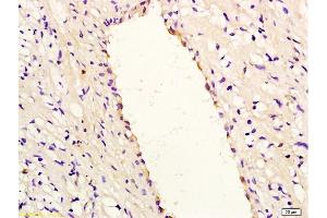 Formalin-fixed and paraffin embedded rabbit carotid artery labeled with Anti-IL-8/CXCL8 Polyclonal Antibody, Unconjugated (ABIN728053) at 1:200, followed by conjugation to the secondary antibody and DAB staining (IL-8 Antikörper  (AA 31-99))