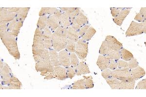 Detection of TNNI2 in Mouse Skeletal muscle Tissue using Polyclonal Antibody to Troponin I Type 2, Fast Skeletal (TNNI2) (TNNI2 Antikörper  (AA 1-182))