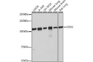 Western blot analysis of extracts of various cell lines, using DDR2 Rabbit mAb (ABIN7266790) at 1:1000 dilution. (DDR2 Antikörper)