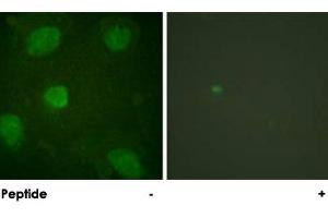 Immunofluorescence analysis of HeLa cells, treated with TNF-a (20 nM, 15 mins), using TGFB1I1 polyclonal antibody . (TGFB1I1 Antikörper)