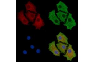 ABIN7095700 and ABIN7099762 staining HepG2 cells by IF/ICC. (PHF15 Antikörper)