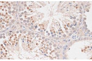 Immunohistochemistry of paraffin-embedded Mouse testis using MAD2L1 Polyclonal Antibody at dilution of 1:100 (40x lens).