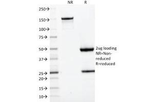 SDS-PAGE analysis of purified, BSA-free CD22 antibody (clone BLCAM/1795) as confirmation of integrity and purity. (CD22 Antikörper  (AA 52-178))