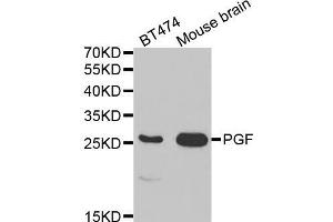 Western blot analysis of extracts of various cell lines, using PGF antibody (ABIN5970864) at 1/1000 dilution. (PLGF Antikörper)