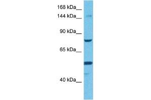 Host:  Rabbit  Target Name:  TMEM2  Sample Tissue:  Human HCT15 Whole Cell  Antibody Dilution:  1ug/ml (TMEM2 Antikörper  (Middle Region))
