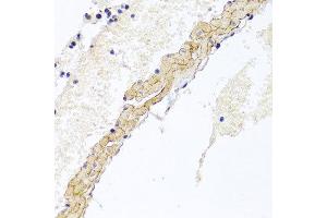 Immunohistochemistry of paraffin-embedded mouse lung using CD81 antibody at dilution of 1:100 (x40 lens). (CD81 Antikörper)
