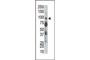 Western Blotting (WB) image for anti-Protein tyrosine Phosphatase, Receptor Type, A (PTPRA) (N-Term) antibody (ABIN360736)