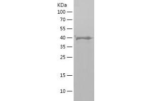Western Blotting (WB) image for Parkinson Protein 2, E3 Ubiquitin Protein Ligase (Parkin) (PARK2) (AA 1-165) protein (His-IF2DI Tag) (ABIN7124320) (Parkin Protein (AA 1-165) (His-IF2DI Tag))