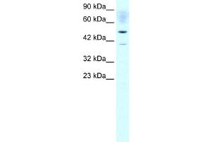 WB Suggested Anti-ACAT2 Antibody Titration:  1. (ACAT2 Antikörper  (Middle Region))