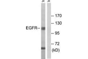 Western blot analysis of extracts from Jurkat cells, treated with UV 15', using EGFR (Ab-998) Antibody. (EGFR Antikörper  (AA 966-1015))