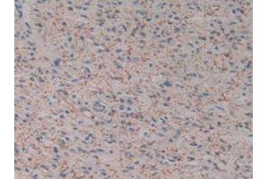 Figure. (Kallikrein 2 Antikörper  (AA 19-261))