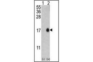 Western blot analysis of MAP1LC3B (arrow) using LC3B Antibody (T6) in Y79 cell line lysates and mouse brain tissue lysates (35 µg/lane).