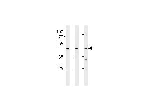 NROB1 Antibody (N-term) (ABIN389157 and ABIN2839323) western blot analysis in Hela,NCI-,PC-3 cell line lysates (35 μg/lane). (NR0B1 Antikörper  (N-Term))