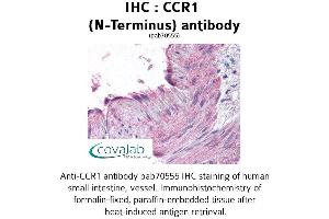 Image no. 1 for anti-Chemokine (C-C Motif) Receptor 1 (CCR1) (Extracellular Domain), (N-Term) antibody (ABIN1732754) (CCR1 Antikörper  (Extracellular Domain, N-Term))