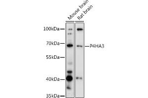 Western blot analysis of extracts of various cell lines, using P4H antibody (ABIN6132886, ABIN6145137, ABIN6145138 and ABIN6217878) at 1:3000 dilution. (P4HA3 Antikörper  (AA 20-110))