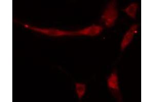 ABIN6274852 staining HeLa cells by IF/ICC. (APOA1BP Antikörper  (Internal Region))