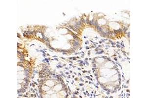 Immunohistochemistry analysis of paraffin-embedded human colon using,CFA (ABIN7076044) at dilution of 1: 300