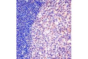 Immunohistochemistry analysis in formalin fixed and paraffin embedded human tonsil tissue reacted with MCM6 Antibody (N-term) followed which was peroxidase conjugated to the secondary antibody and followed by DAB staining. (MCM6 Antikörper  (N-Term))