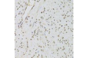 Immunohistochemistry of paraffin-embedded human leiomyoma of uterus using RUVBL1 Antibody. (RUVBL1 Antikörper  (AA 1-240))