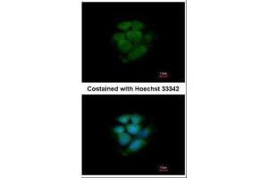 ICC/IF Image Immunofluorescence analysis of methanol-fixed MCF-7, using JNK2, antibody at 1:200 dilution. (JNK2 Antikörper)