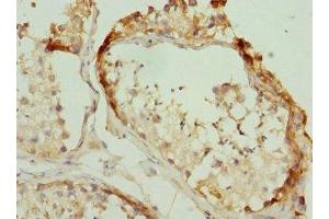 Immunohistochemistry of paraffin-embedded human testis tissue using ABIN7142727 at dilution of 1:100