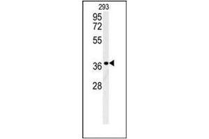 Western blot analysis of LGALS9B Antibody (Center) in 293 cell line lysates (35ug/lane). (LGALS9B Antikörper  (Middle Region))