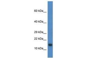 Image no. 1 for anti-Proline Rich Nuclear Receptor Coactivator 2 (PNRC2) (N-Term) antibody (ABIN6746484) (PNRC2 Antikörper  (N-Term))