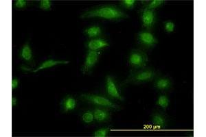 Immunofluorescence of monoclonal antibody to AKR1B10 on HeLa cell. (AKR1B10 Antikörper  (AA 76-143))