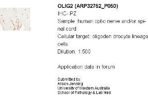 Sample Type: Human Optic Nerve and Spinal CordCellular Target: Oligoden Drocyte Lineage CellsDilution: 1:500 (OLIG2 Antikörper  (N-Term))