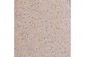 IHC analysis of Septin 11/SEPTIN11 using anti-Septin 11/SEPTIN11 antibody (ABIN7602925). (Septin 11 Antikörper  (C-Term))