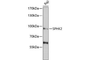 Western blot analysis of extracts of Raji cells, using SPHK2 antibody (ABIN6128746, ABIN6148347, ABIN6148348 and ABIN6222478) at 1:1000 dilution. (SPHK2 Antikörper  (AA 1-165))