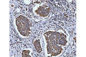 IHC analysis of SIRT5 using anti-SIRT5 antibody (ABIN7602524).