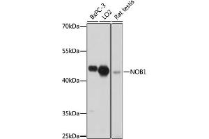 Western blot analysis of extracts of various cell lines, using NOB1 antibody (ABIN7270109) at 1:1000 dilution.