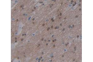 Used in DAB staining on fromalin fixed paraffin- embedded Kidney tissue (ARNT2 Antikörper  (AA 1-209))