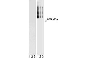 Western Blot analysis of TRA-1-60 in mouse and human ES cell lines. (TRA1-81 Antikörper)