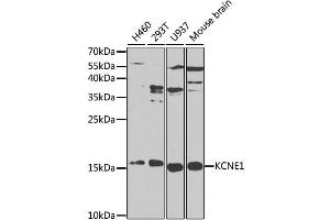 Western blot analysis of extracts of various cell lines, using KCNE1 antibody (ABIN1873374) at 1:1000 dilution. (KCNE1 Antikörper)