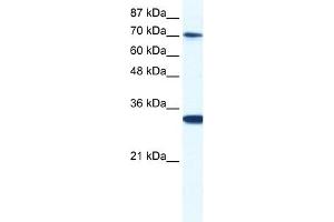 WB Suggested Anti-CNOT3 Antibody Titration:  0. (CNOT3 Antikörper  (N-Term))