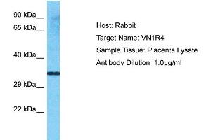 Host: Rabbit Target Name: VN1R4 Sample Type: Placenta lysates Antibody Dilution: 1.