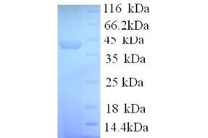 SDS-PAGE (SDS) image for Synapsin I (SYN1) (AA 113-420), (partial) protein (His tag) (ABIN5713868) (SYN1 Protein (AA 113-420, partial) (His tag))
