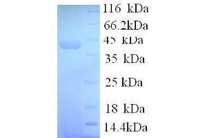 SDS-PAGE (SDS) image for Synapsin I (SYN1) (AA 113-420), (partial) protein (His tag) (ABIN4976575) (SYN1 Protein (AA 113-420, partial) (His tag))