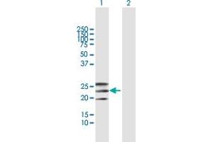 Western Blot analysis of EFNA2 expression in transfected 293T cell line by EFNA2 MaxPab polyclonal antibody. (Ephrin A2 Antikörper  (AA 1-213))