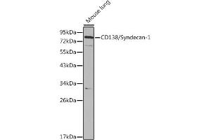 Western blot analysis of extracts of Mouse lung cells, using CD138/Syndecan-1 antibody (ABIN3021804, ABIN3021805, ABIN3021806 and ABIN6215950) at 1:1000 dilution. (Syndecan 1 Antikörper  (AA 25-240))