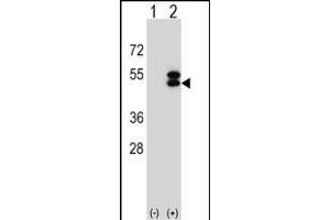 Western blot analysis of ATXN3 (arrow) using rabbit polyclonal ATXN3 Antibody (Center) (ABIN653191 and ABIN2842741). (Ataxin 3 Antikörper  (AA 261-288))