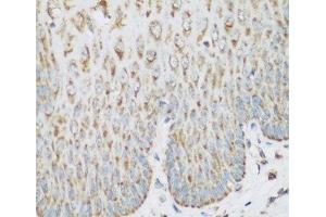 Immunohistochemistry of paraffin-embedded Human esophagus using IGF2BP3 Polyclonal Antibody at dilution of 1:200 (40x lens). (IGF2BP3 Antikörper)