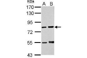 WB Image Sample (30 ug of whole cell lysate) A: THP-1 B: HL-60 7. (Protein Red (IK) (N-Term) Antikörper)