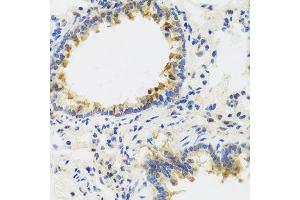 Immunohistochemistry of paraffin-embedded rat lung using UVRAG antibody. (UVRAG Antikörper  (AA 501-699))