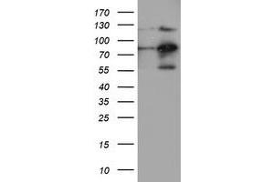 Western Blotting (WB) image for anti-Folate Hydrolase (Prostate-Specific Membrane Antigen) 1 (FOLH1) antibody (ABIN1500454) (PSMA Antikörper)