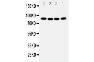 Anti-Cullin 2 antibody, Western blotting Lane 1: A431 Cell Lysate Lane 2: SMMC Cell Lysate Lane 3: HELA Cell Lysate Lane 4: COLO320 Cell Lysate (Cullin 2 Antikörper  (Middle Region))